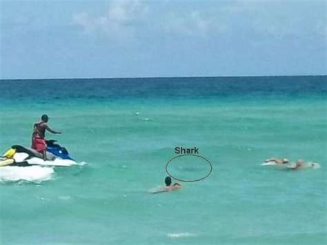 Man survives shark bites to both legs off Florida coast - ABC News