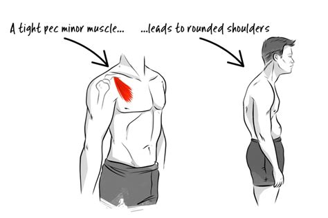 How To Massage Shoulder Blade - Find Relief from Tension & Stress with These Simple Steps!