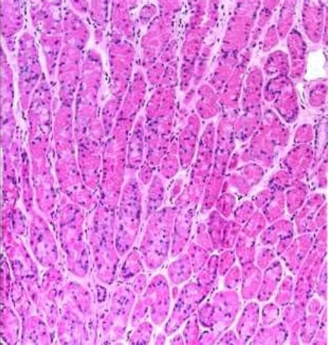 The Interstitium, the Largest Organ We Never Knew We Had | Organs, Lymph system, Scientific reports