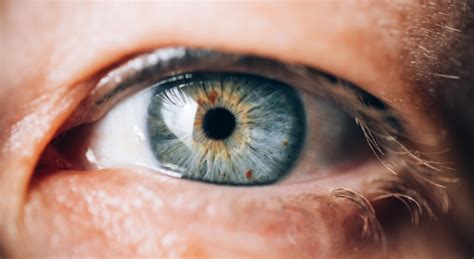 What Are Eye Freckles and Are They Harmless? | Comprehensive Eye Care in Seattle and Bellevue ...