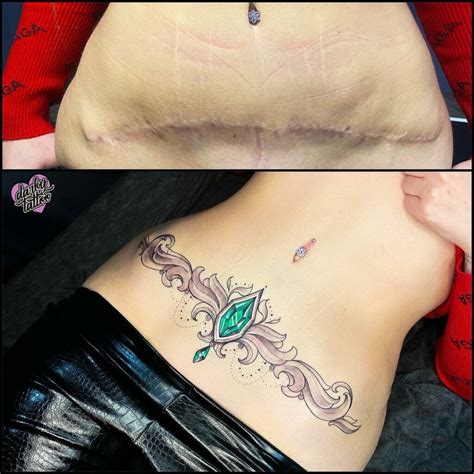 10 Best Hysterectomy Scar Tattoo Ideas That Will Blow Your Mind!