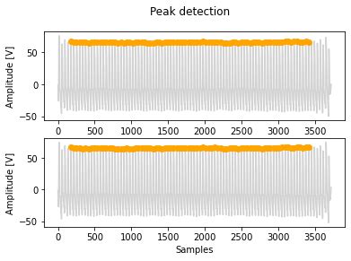 Beat detection — Signal Processing and Learning for Wearables