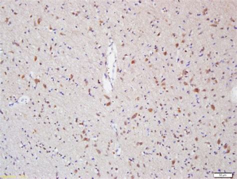 Myelin Protein Zero Antibody (BS-0337R)