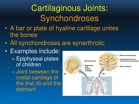 Joints. - ppt download