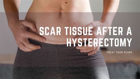 Scar Tissue After A Hysterectomy - Treat Your Scars