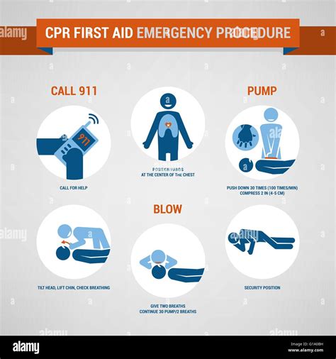 Cpr first aid and training procedure, emergency and healthcare concept Stock Vector Image & Art ...