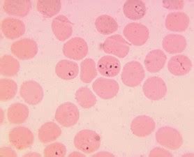 Free picture: photomicrograph, blood smear, plasmodium falciparum, rings, erythrocytes