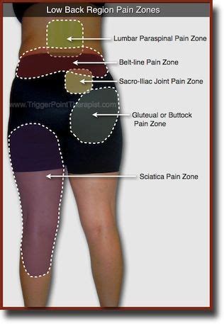 pain relief remedies: The Low Back Pain Sciatica Protocol