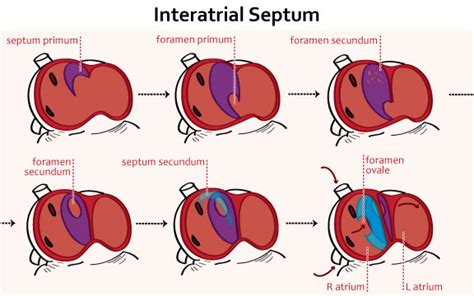 Cardiac Development - USMLE Strike