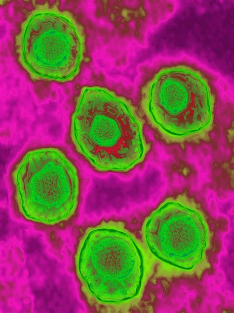 Mononucleosis (Mono): Overview and More