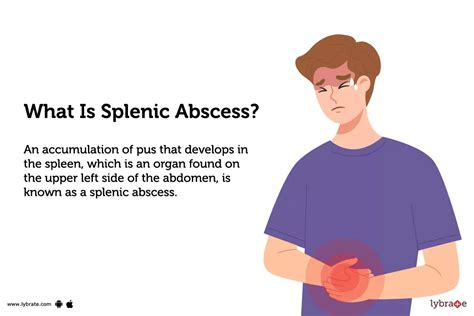 Splenic Abscess: Causes, Symptoms, Treatment and Cost