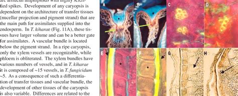 Details of caryopsis structure in T. kiharae (A, C, E, G, and H) and T ...