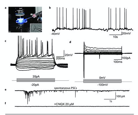 Basal functional characterization of human neurons in the microdevice ...