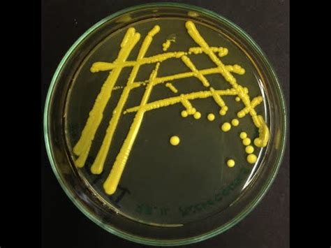 Micrococcus luteus: characteristics, morphology, diseases - science - 2024