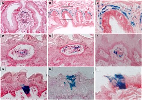 LacZ staining in lingual epithelia and papillae after 10 days of Dox ...