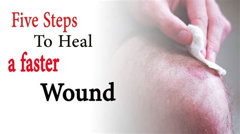 How to heal wounds fast home remedies | 5 Steps to Heal a Faster Wound | Heal wounds faster ...