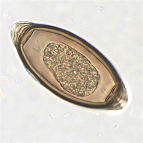 Trichuriasis causes, prevention, symptoms, diagnosis & treatment