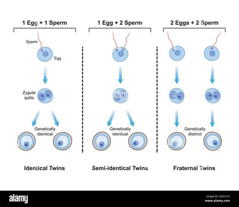 Fraternal and identical twins Stock Vector Images - Alamy