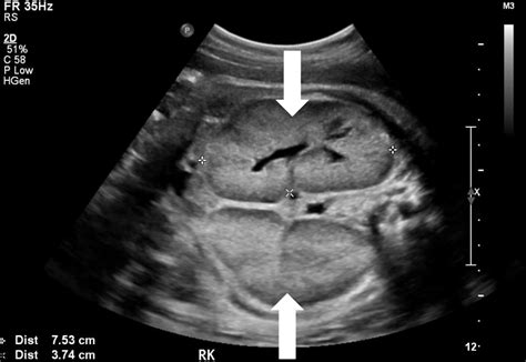 Pin on Ultrasound Images