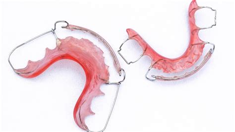 4 Tips for a Clean Retainer | Lucio H. Kim DDS Blog