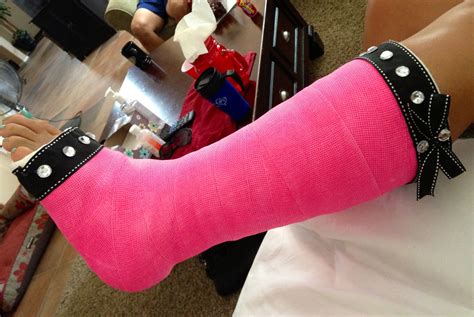 My new bling pink cast. Decorated leg cast. | Leg cast, It cast, Cast decoration