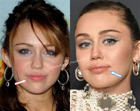 Miley Cyrus, BEFORE and AFTER 2022