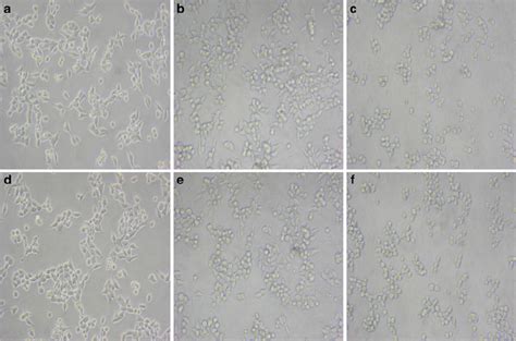 a – f MCF-7 cell line. a Before treatment with AU01 protease, b 1 min ...