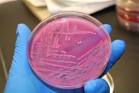 E. coli on MAC | VeeDunn | Flickr