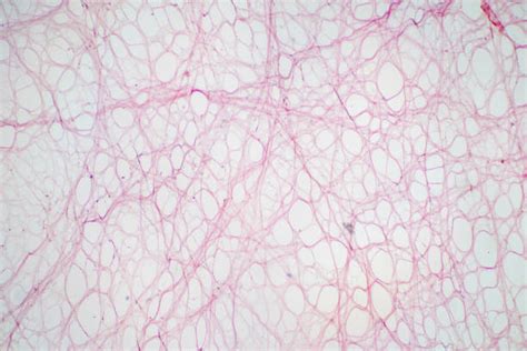 460+ Collagen Fibers Histology Stock Photos, Pictures & Royalty-Free Images - iStock