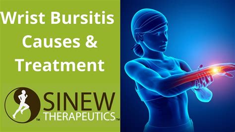 Wrist Bursitis Causes and Treatment - YouTube