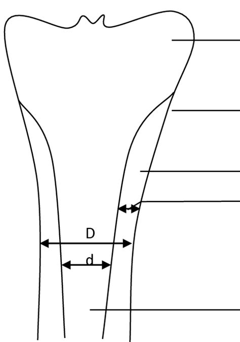 3: Measurement of cortical thickness. | Download Scientific Diagram