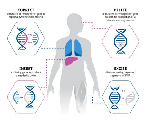 Gene Therapy - Precision BioSciences