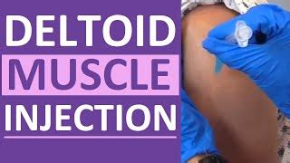 Intramuscular Injection in Deltoid Muscle with Z-Track Technique | Music Jinni