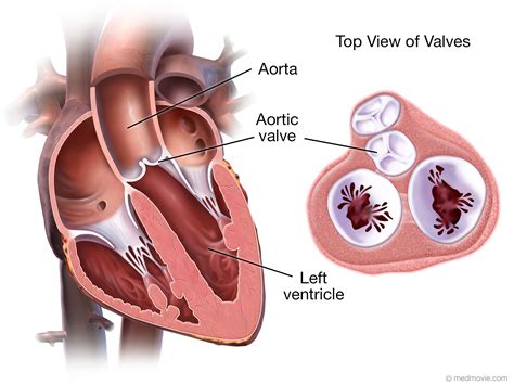 Aortic Valve – Medmovie.com