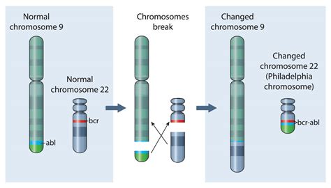 Chronic Myeloid Leukaemia (CML): Signs, Diagnosis & Treatment in Singapore | PCC Sri Lanka