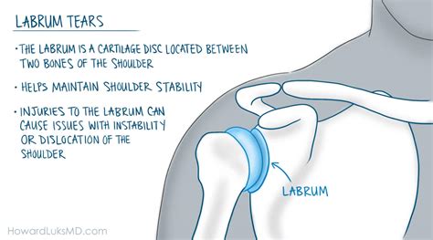 Serious Shoulder Injuries. When Should I See A Doctor?