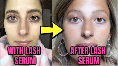 WHAT HAPPENS AFTER LASH SERUM? I'M HERE TO TELL YOU! Before & After Results - YouTube