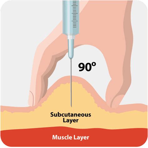 Insulin Injection Sites: Where And How To Inject, 56% OFF