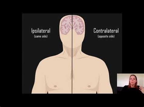 Ipsilateral vs Contralateral - YouTube