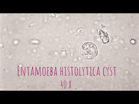 Entamoeba Histolytica cyst under microscope at 40X. - YouTube