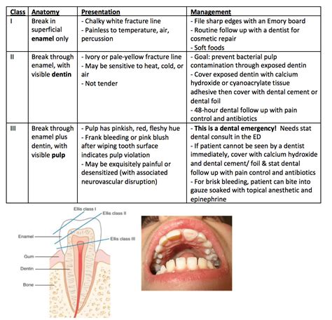 Dental Trauma – Core EM