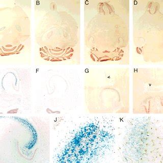 Regional expression of-galactosidase activity in brain sections of... | Download Scientific Diagram