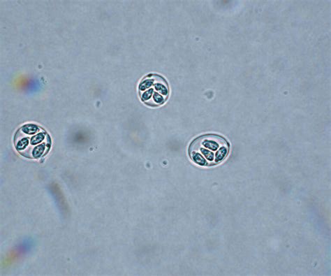 Understanding highly pathogenic Eimeria species in turkeys - Poultry World