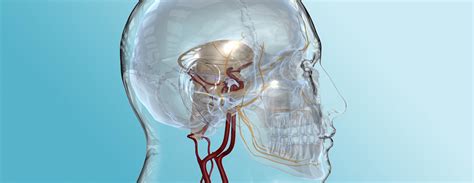 Microvascular Decompression | Conditions & Treatments | UCSF Health