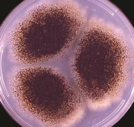 Aspergillus Niger Culture