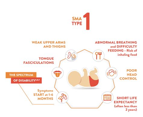 Types of SMA