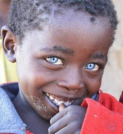 Menino africano nasce com olhos azuis e é chamado de “Olhos de Safira ...