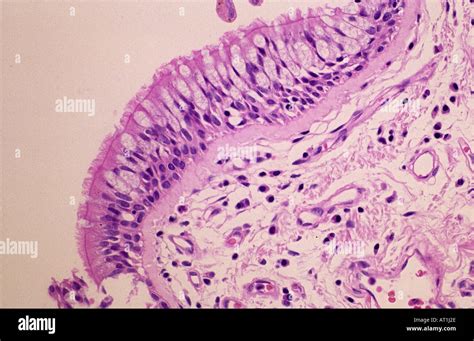 Epithelial tissue of trachea Tracheal epithelium Stock Photo - Alamy