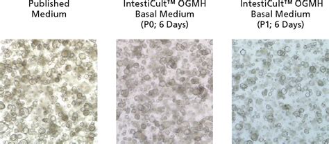 Culturing Intestinal Cancer-Derived Organoids