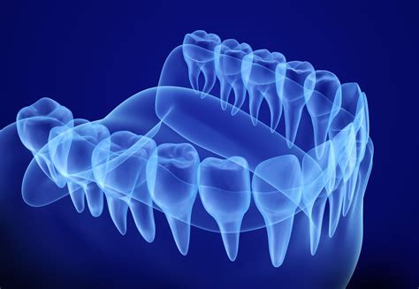 Radiología Digital: Nuestros Servicios de Bonestar Clínica Dental